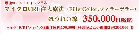 �}�C�N���b�q�e�Ö@�iFillerGeller�A�t�B���[�Q���[�j �ق��ꂢ���@342,000�~