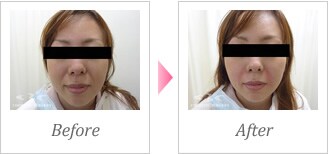 プチ若返り