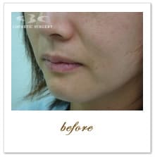 �g�����X�@ �{�p�O