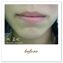 �g�����X�@ �{�p�O