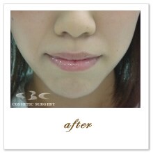 �g�����X�@ �{�p��