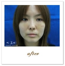 �g�����X�@ �{�p��