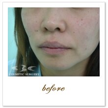 �g�����X�@ �{�p�O