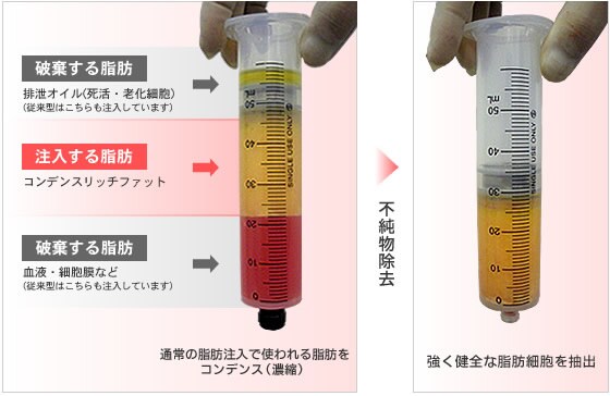 コンデンス(濃縮)技術 空気に触れないプロセス