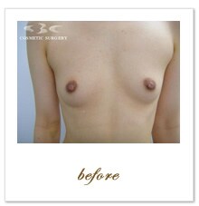 �X�[�p�[�������b���זE�����@ �{�p�O �{�p�O
