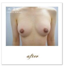 �X�[�p�[�������b���זE�����@ �{�p�O �{�p��