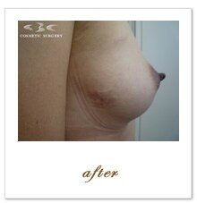 MAX�������b���זE�����@ �{�p��