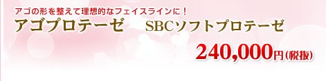 �A�S�v���e�[�[ SBC�\�t�g�v���e�[�[ 252,000�~