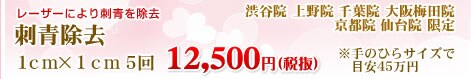 刺青除去 75,000円