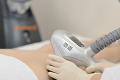 ���F���V�F�C�v�iVelaShape�j