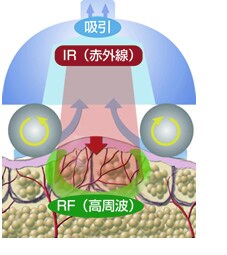 ���F���V�F�C�v�iVelaShape�j�̃g���v���A�v���[�`
