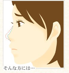 ぺちゃ鼻