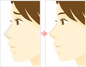 美容整形 レディエッセ