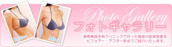 �t�H�g�M�������[