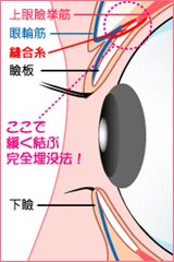 挙筋