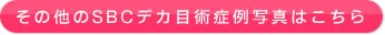 ���̑���SBC�f�J�� �p�Ǘ�ʐ^�͂�����