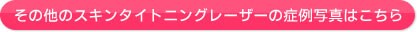 ���̑��X�L���^�C�g�j���O���[�U�[�̏Ǘ�ʐ^�͂�����