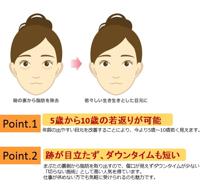 目の下の切らないたるみとり 特徴1