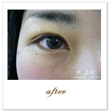 �QDAYS�N�C�b�N�@ ��p��