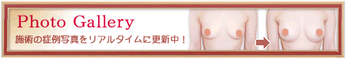 �t�H�g�M�������[