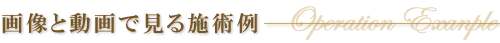 �摜�Ɠ���Ō���{�p��
