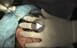 ���؃h�N�^�[�̎�Ԃ莡�Áu���v�g�X���g�p��V-TOSIS�i���j�j�v