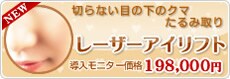 レーザーアイリフト