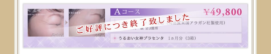 �`�R�[�X
