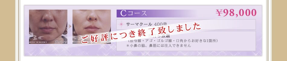 �b�R�[�X