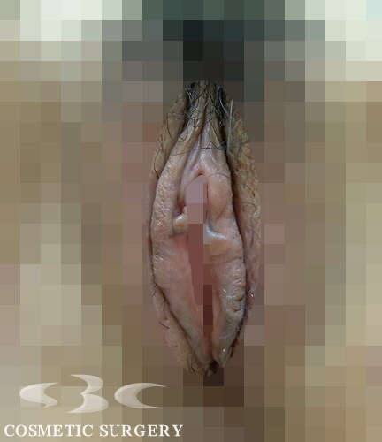 �w�l��