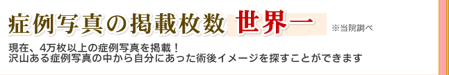 �Ǘ�ʐ^�̌f�ږ����@���E��