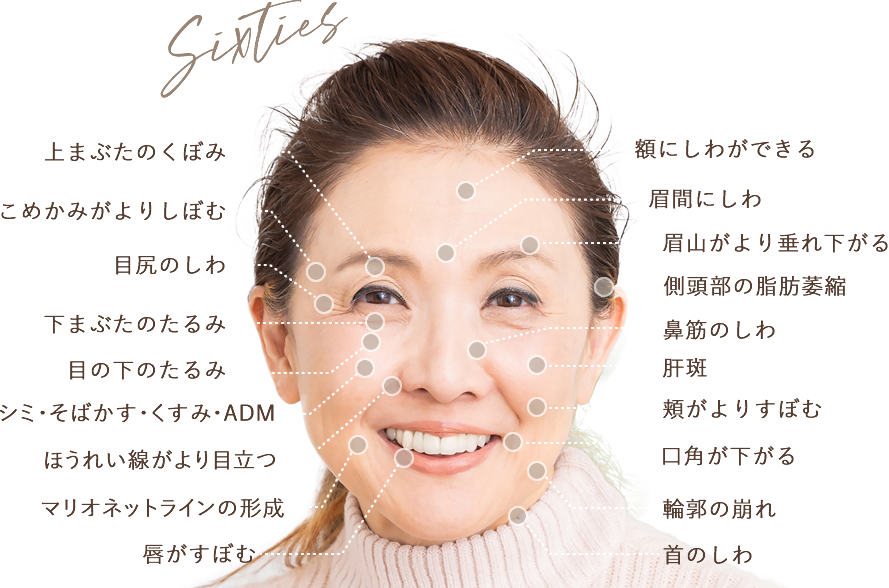 60代のしわ・シミ・たるみのお悩み