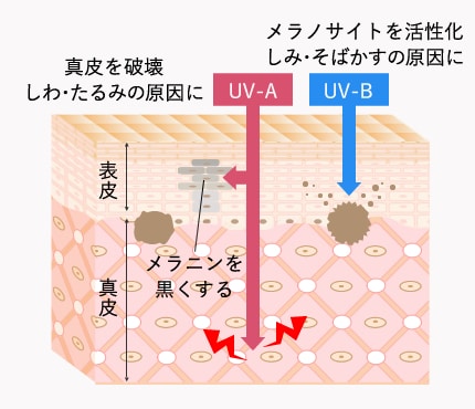 紫外線による光老化の構造