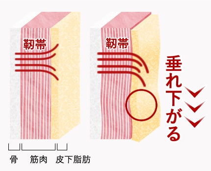 顔面の靭帯は重度のシワと関係