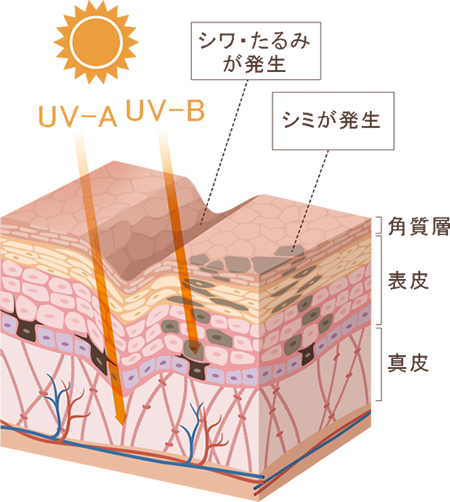 紫外線による光老化の構造