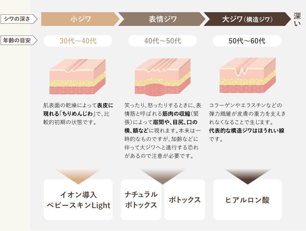しわの深さと年齢によるおすすめ施術