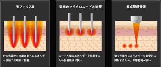 モフィウス８