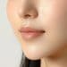 長い鼻下を短くさせるには？主な原因や人中短縮治療と注意点を解説