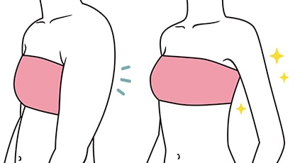 二の腕セット 症例写真 Before After