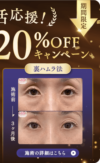 裏ハムラ法 キャンペーン