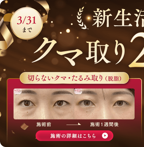 目の下の切らないクマ取り・たるみ（ふくらみ）取り キャンペーン