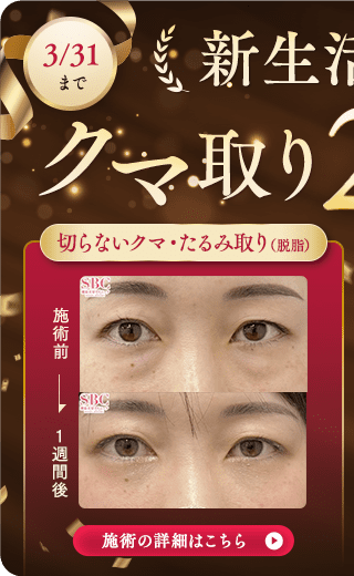 目の下の切らないクマ取り・たるみ（ふくらみ）取り キャンペーン