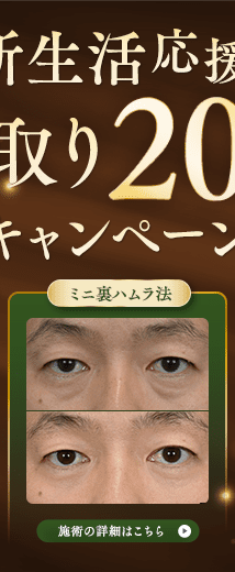 ミニ裏ハムラ法 キャンペーン