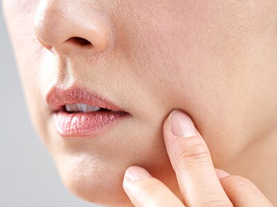 乾燥しやすい口周り