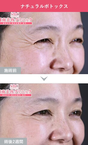 症例写真1