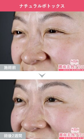 症例写真3