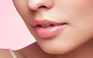 唇ヒアルロン酸