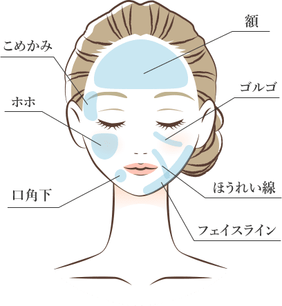 こめかみ ホホ 広角下 額 ゴルゴ ほうれい線 フェイスライン