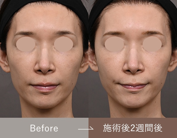 症例写真3