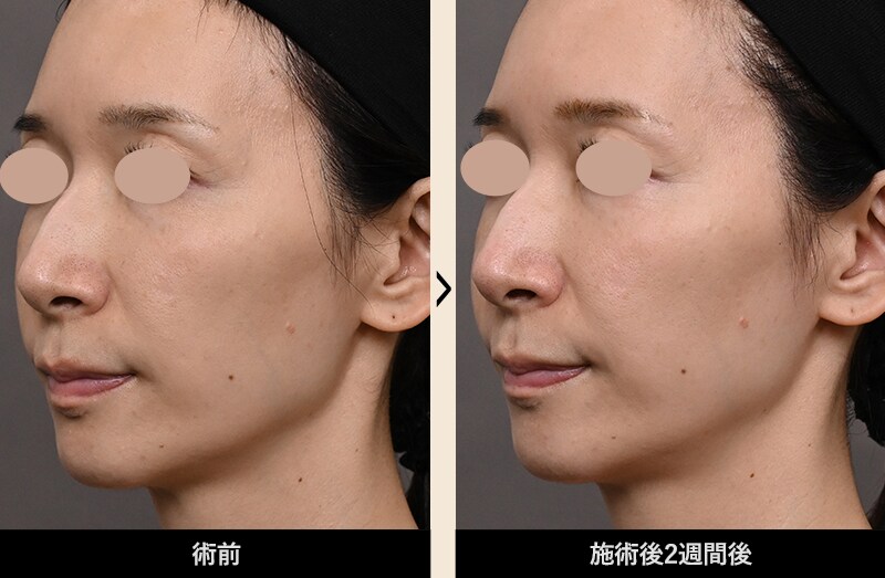 症例写真 Before After